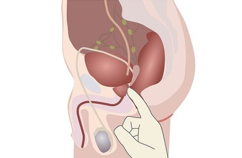 anatomi prostat lalaki